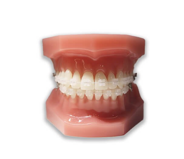 SMILE ACCESS 矯正プロパートナーズ | 一般歯科向け 矯正治療